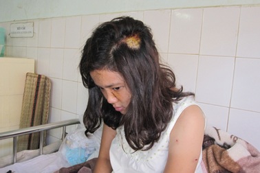 Bị đâm rách mặt vì giúp người khác khuyên con bỏ chơi bời