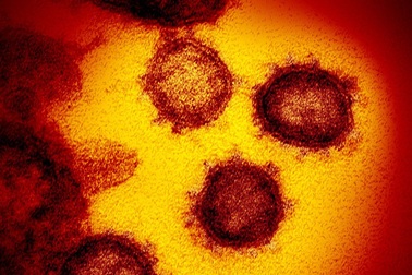 Nghiên cứu: Virus corona có thể đã lây ở người hàng chục năm