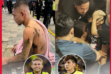 Ngôi sao đội tuyển Malaysia bị tấn công