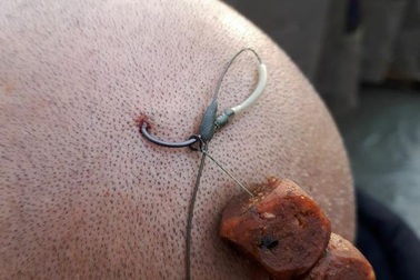 "Số nhọ" đi câu cá quăng móc câu trúng... đầu