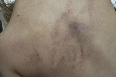 Điều tra phản ánh bé gái 4 tuổi bị cô giáo đánh, kéo lê, ném vào tường