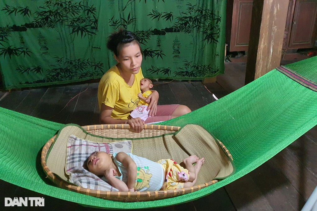 Nỗi đau người mẹ sống như đã chết khi có 2 con mắc bệnh teo não bẩm sinh - 6 Nỗi đau người mẹ sống như đã chết khi có 2 con mắc bệnh teo não bẩm sinh - 6
