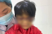 Bé gái 6 tuổi bị mẹ đẻ bạo hành thâm tím mặt mũi, nhốt trong nhà