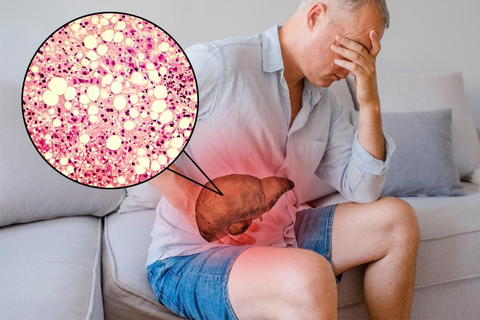 "Bước đệm" dẫn đến xơ gan trong gang tấc nhiều người thường chủ quan