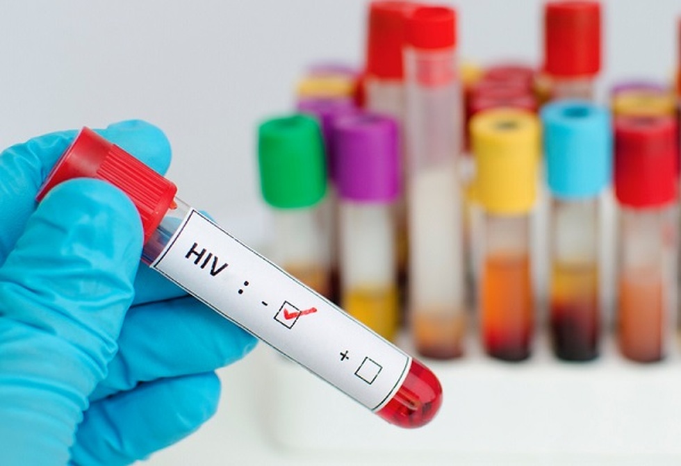 Người thứ 7 khỏi HIV: Sắp tới chương cuối của căn bệnh thế kỷ? - 1 Người thứ 7 khỏi HIV: Sắp tới chương cuối của căn bệnh thế kỷ? - 1