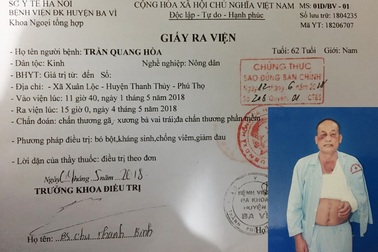 Giám đốc Công an tỉnh chỉ đạo xem lại vụ bị đánh gãy xương còn “dính” phạt