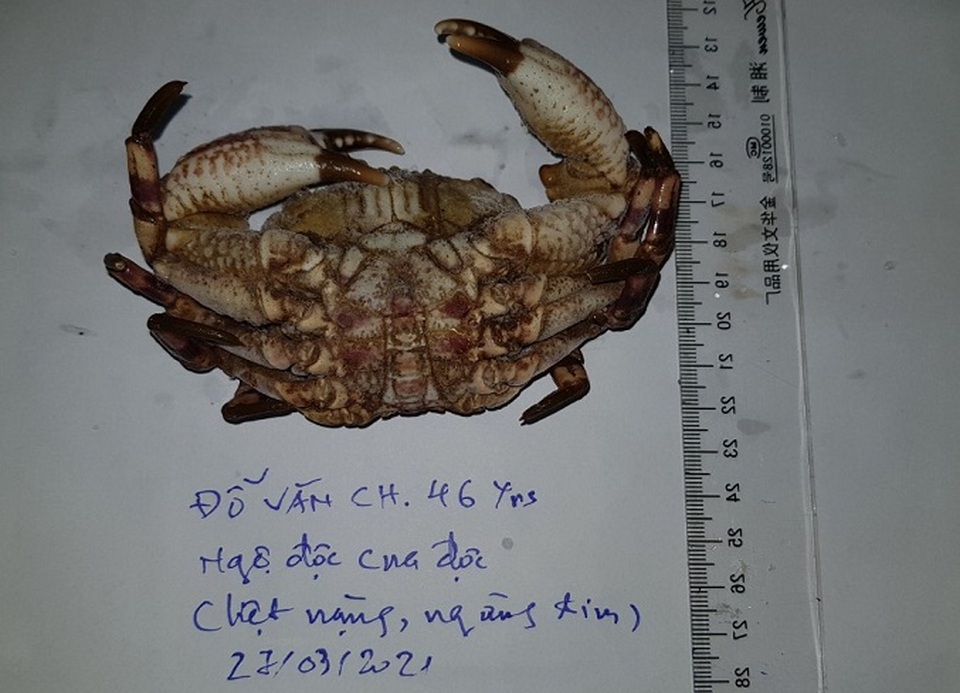 Người đàn ông ngừng tim sau khi ăn cua mặt quỷ - 3 Người đàn ông ngừng tim sau khi ăn cua mặt quỷ - 3
