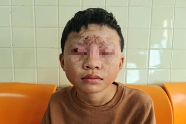 Ẩn họa khôn lường từ việc học sinh lên mạng học chế tạo pháo nổ