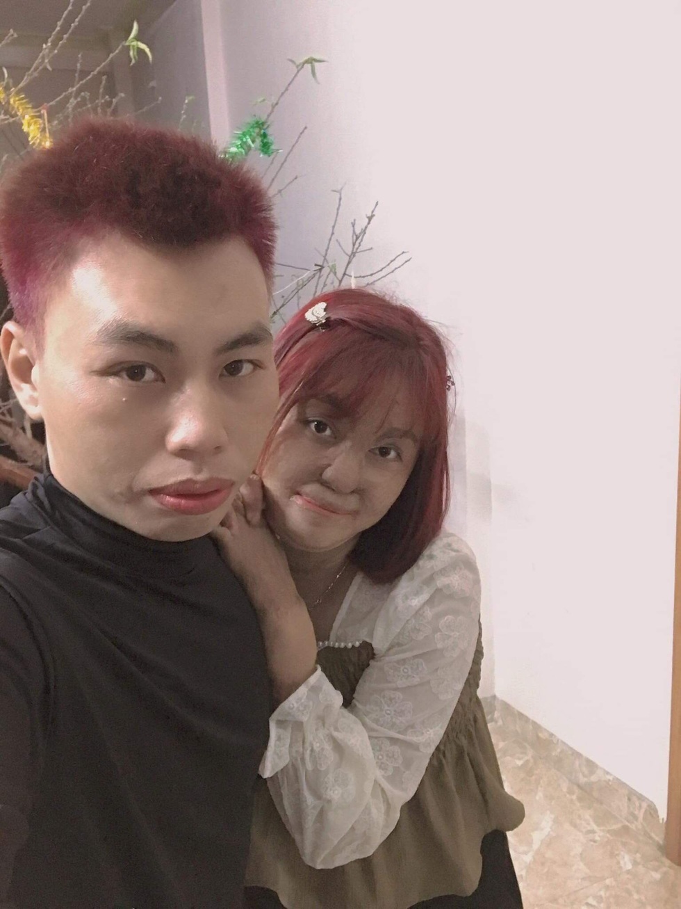 Hạnh phúc mới của cô gái Hà Nội bị chồng cũ tẩm xăng thiêu sống - 3 Hạnh phúc mới của cô gái Hà Nội bị chồng cũ tẩm xăng thiêu sống - 3