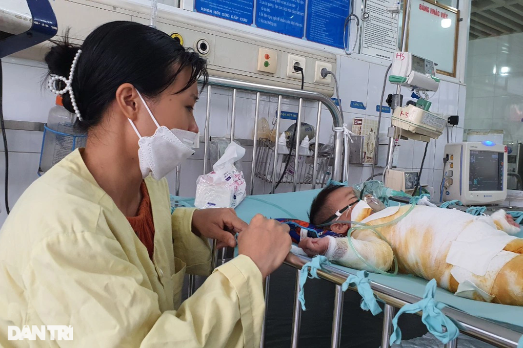 Bỏng nước sôi 66% cơ thể, bé 20 tháng tuổi nguy kịch xin cứu tính mạng - 8 Bỏng nước sôi 66% cơ thể, bé 20 tháng tuổi nguy kịch xin cứu tính mạng - 8