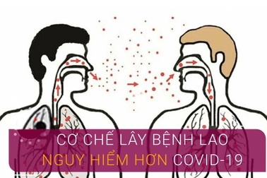 Quản lý điều trị người bệnh lao các tuyến kết hợp dự phòng Covid-19