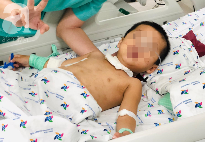 TP.HCM: Người phụ nữ nguy kịch vì bị hạt chà là đâm thủng ruột trong lúc ăn - Ảnh 4. TP.HCM: Người phụ nữ nguy kịch vì bị hạt chà là đâm thủng ruột trong lúc ăn - Ảnh 4.
