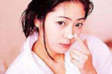 Phòng chống mụn trứng cá trong mùa hè 