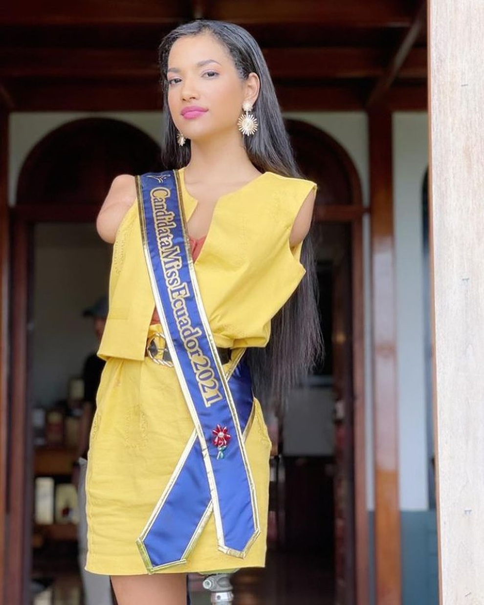 Bị điện giật lúc 5 tuổi, cô gái một chân có nghị lực sống đáng khâm phục - 4