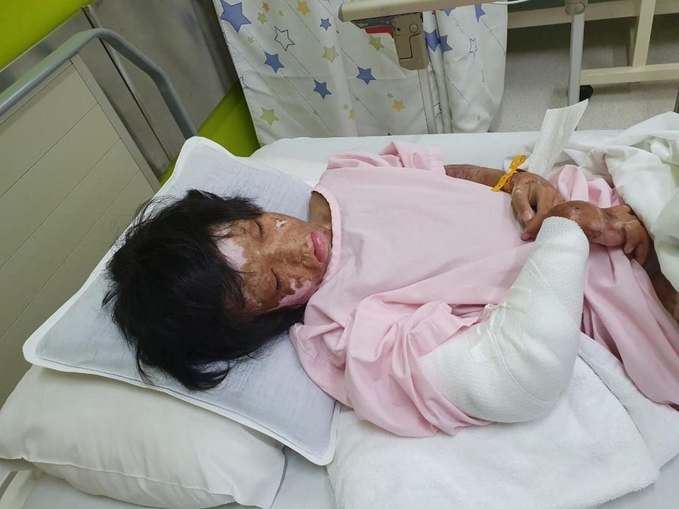 “Phù thủy” phẫu thuật, cứu chân tay co rút gân cho trẻ em nghèo - 2 “Phù thủy” phẫu thuật, cứu chân tay co rút gân cho trẻ em nghèo - 2