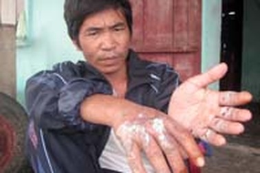 Điện giật 4 người rơi từ mái nhà xuống đất