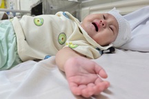 Bé 7 tháng tuổi khuyết hộp sọ, mẹ nghèo khẩn cầu cơ hội sống cho con