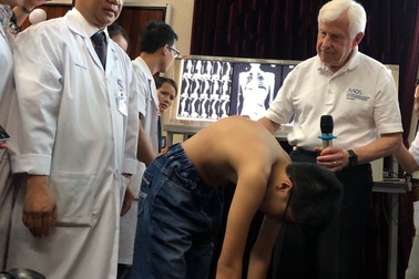 Cha mẹ có thể nhận biết con bị vẹo cột sống nhờ động tác đơn giản