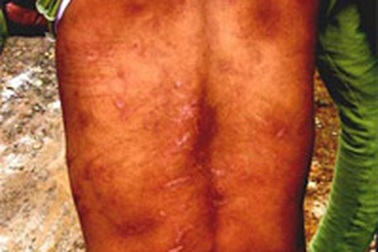 Nhiều bậc cha mẹ “chung tay” ngược đãi con trẻ