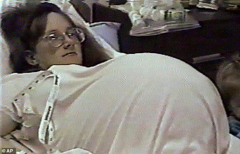 Ca sinh 7 đầu tiên gây sửng sốt thế giới sau 28 năm giờ ra sao? - 2