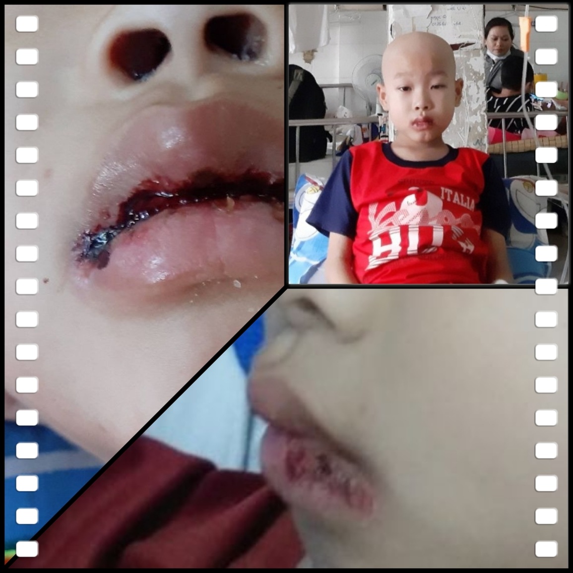 Xót thương vợ chồng hiếm muộn có bé con duy nhất lại mắc bệnh hiểm nghèo - 3 Xót thương vợ chồng hiếm muộn có bé con duy nhất lại mắc bệnh hiểm nghèo - 3