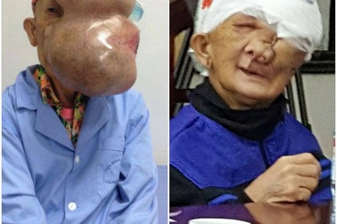 “Sơn nữ” được giải phóng khỏi gương mặt quỷ