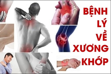 Việt Nam chiết xuất thành công hoạt chất mới tốt cho bệnh khớp