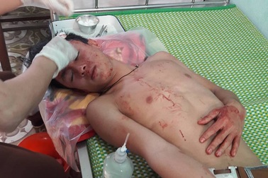 Khởi tố nhóm thanh niên vào trường học gây rối, đánh thầy giáo, học sinh nhập viện