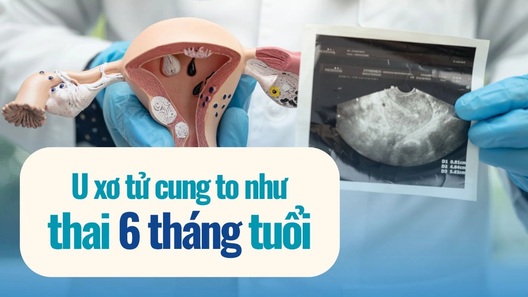 Tưởng béo bụng, người phụ nữ mang khối u như thai 6 tháng suốt nhiều năm