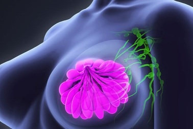 Tiết dịch núm vú thế nào là bình thường và bất thường?