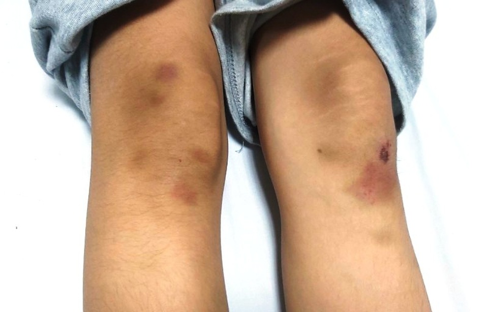 Bộ GDĐT: Kỉ luật nghiêm khắc nhóm cổ vũ và đánh hội đồng học sinh lớp 8 - 2 Bộ GDĐT: Kỉ luật nghiêm khắc nhóm cổ vũ và đánh hội đồng học sinh lớp 8 - 2