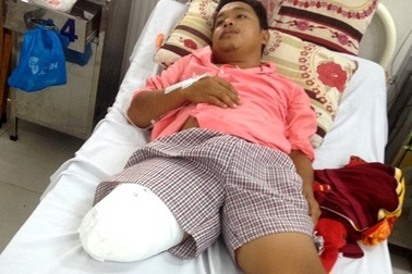 Vụ cưa cụt chân: Bộ Y tế yêu cầu chấn chỉnh hoạt động chuyên môn