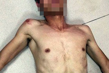 Hà Nội: Giải cứu cô gái trẻ bị khống chế trong nhà nghỉ