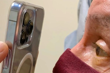 Dùng iPhone 13 Pro Max để khám mắt cho bệnh nhân