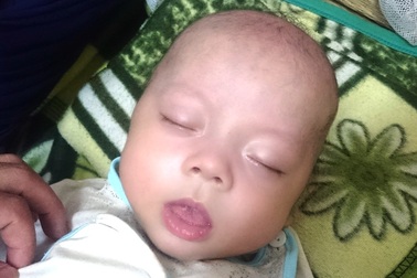 Bé trai 4 tháng tuổi thoi thóp thở vì bệnh tim bẩm sinh