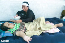 Hoàn cảnh bi đát của người phụ nữ 62 tuổi mang hình hài của trẻ