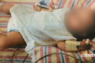 Vợ chồng ăn chay để con 20 tháng tuổi nặng chưa đến 5kg, còi xương và không mọc nổi răng