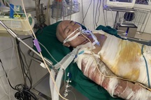 Đau nhói lòng cảnh người mẹ đi kiếm cái ăn nuôi 3 con bị ngã vào bếp hấp cá