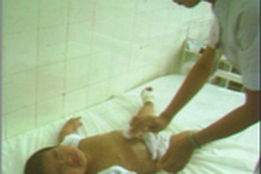 Sốt co giật ở trẻ: Dễ tái phát 