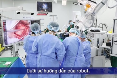 Mổ não với robot AI
