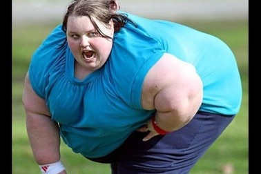 Người béo phì có nguy cơ mắc ung thư cao hơn 50%