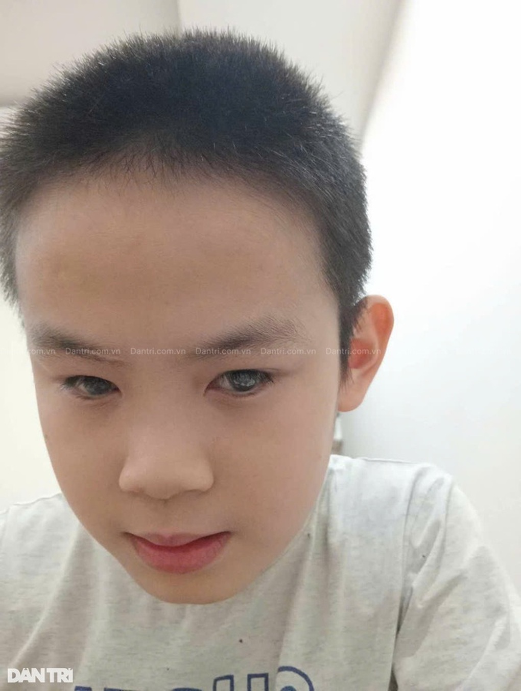 Mẹ trẻ cầu xin cứu giúp con 2 tháng tuổi có nguy cơ mù như anh trai - 2 Mẹ trẻ cầu xin cứu giúp con 2 tháng tuổi có nguy cơ mù như anh trai - 2