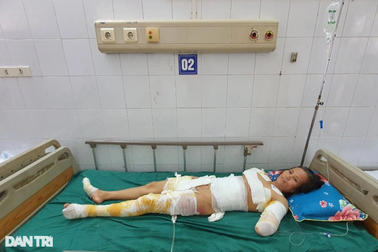 Người mẹ 2 con đổ gục sau cú phóng điện kinh hoàng