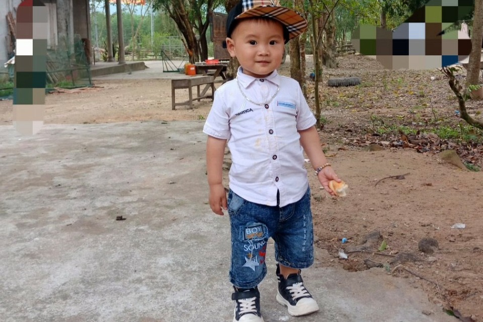 Đau nhói lòng cảnh cậu bé 2 tuổi bị bỏng xăng nặng do chơi trò sinh nhật - 7 Đau nhói lòng cảnh cậu bé 2 tuổi bị bỏng xăng nặng do chơi trò sinh nhật - 7