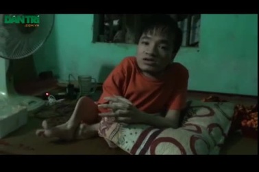 Cậu bé khuyết tật tâm sự về việc cắt 5 ngón tay đi đòi công lý cho mẹ.