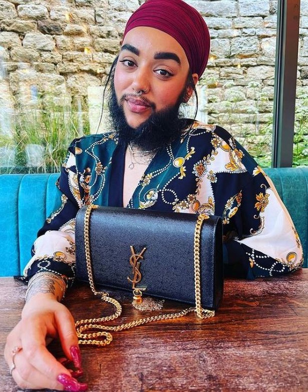 Cô gái có râu trở thành nhà hoạt động xã hội chống bắt nạt - 1