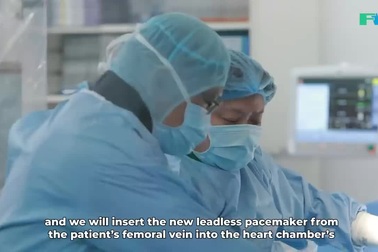 Ưu điểm của máy tạo nhịp tim không dây cảm biến buồng nhĩ