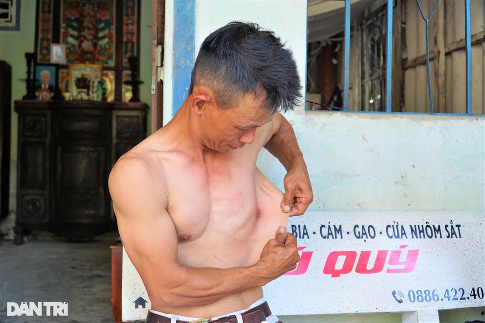 Người đàn ông miền Tây có làn da kéo giãn như cao su tay chân bẻ gập 180 độ - 6 Người đàn ông miền Tây có làn da kéo giãn như cao su tay chân bẻ gập 180 độ - 6