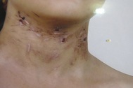 Vụ cháu bé bị vứt ra nghĩa địa: "Tôi đau lòng nhưng tôi chấp nhận"