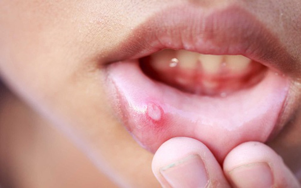 8 dấu hiệu ung thư nhiều người thường không biết - 2 8 dấu hiệu ung thư nhiều người thường không biết - 2